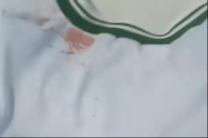 Aluno mostra uniforme com marca de sangue após ataque (Foto/Reprodução)