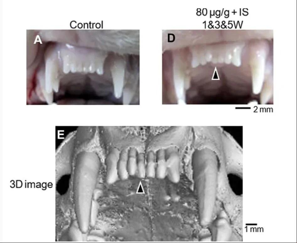Remédio que faz dentes crescerem é esperança da ciência para resolver casos de doenças congênitas (Foto/Divulgação)